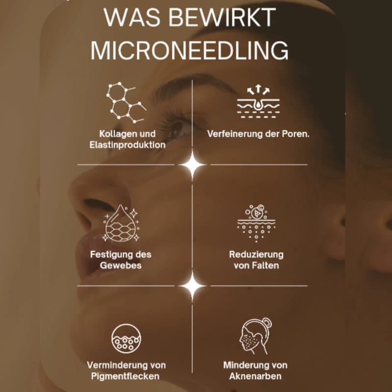 Was bewirkt Microneedling: sechs Wirkfelder im Überblick